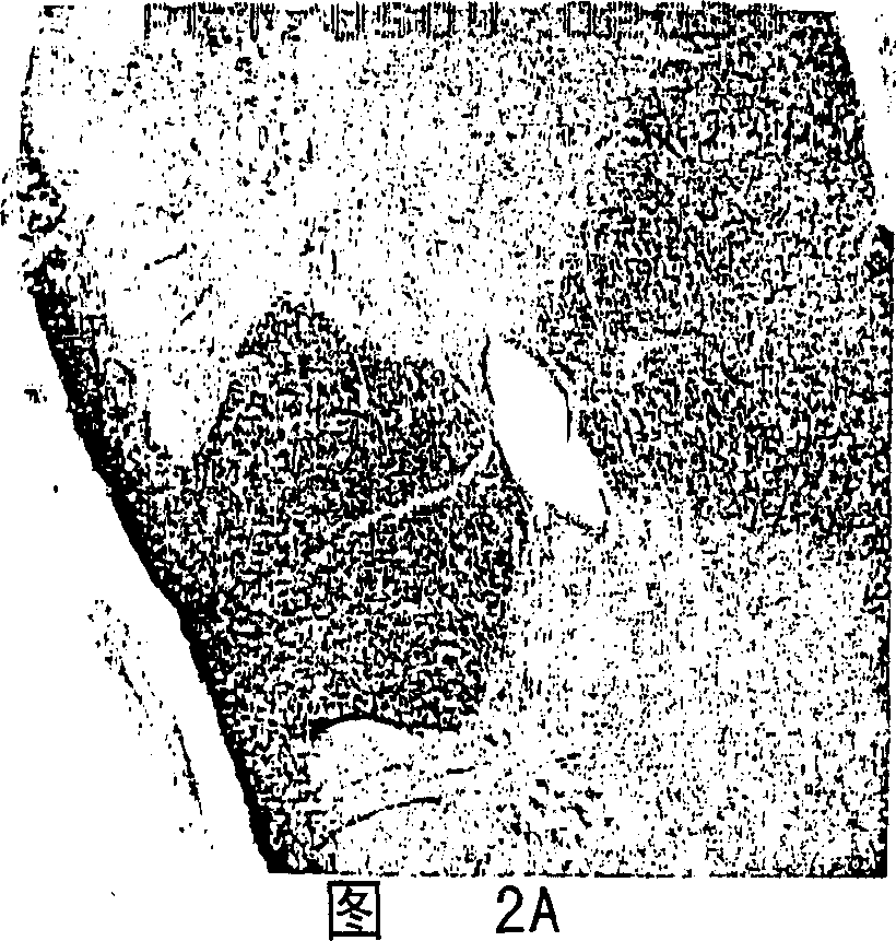 Composition for and treatment of demyelinating diseases and paralysis by administration of remyelinating agents