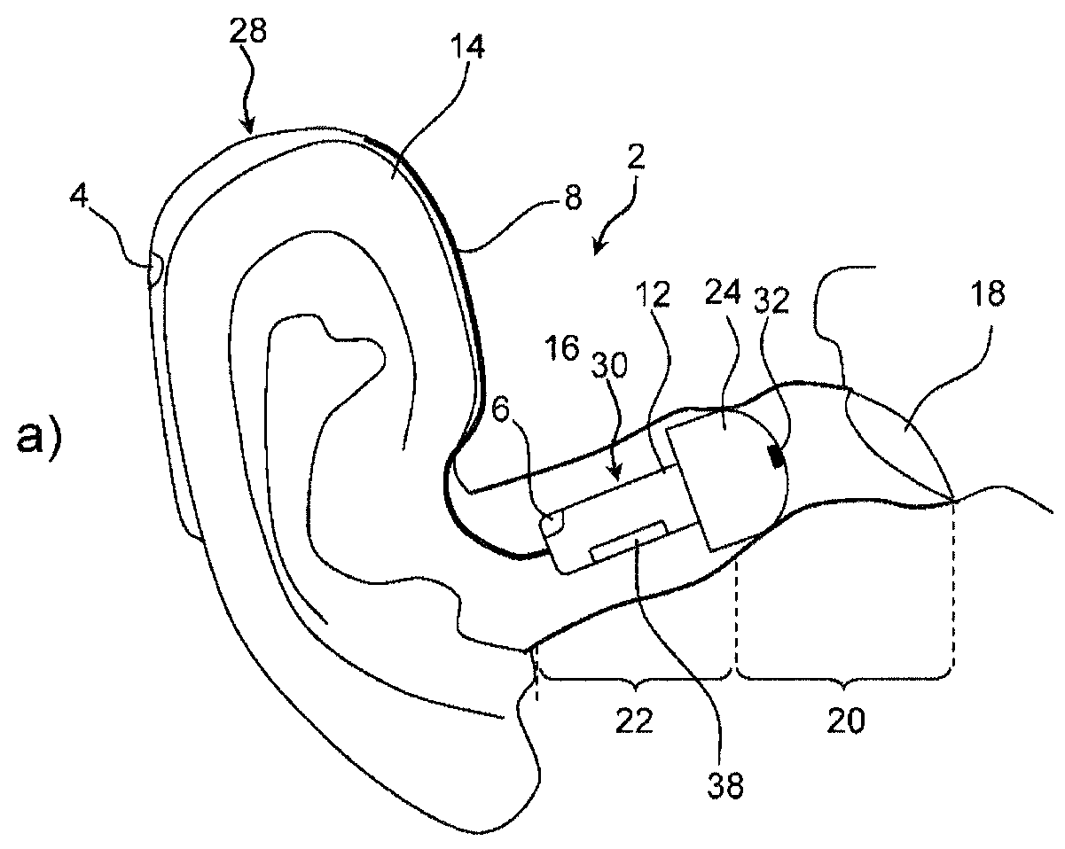 Hearing aid device and method for feedback reduction