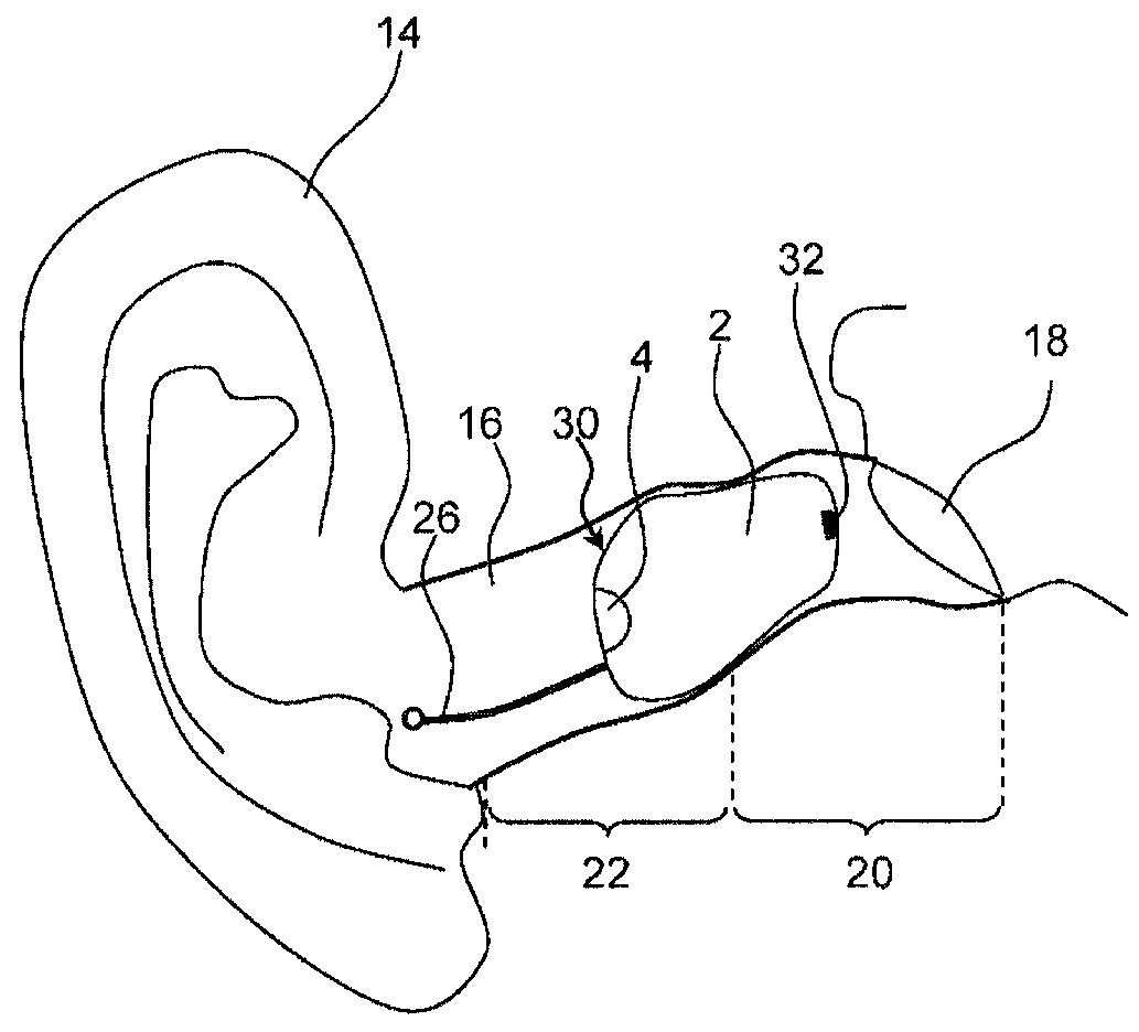 Hearing aid device and method for feedback reduction