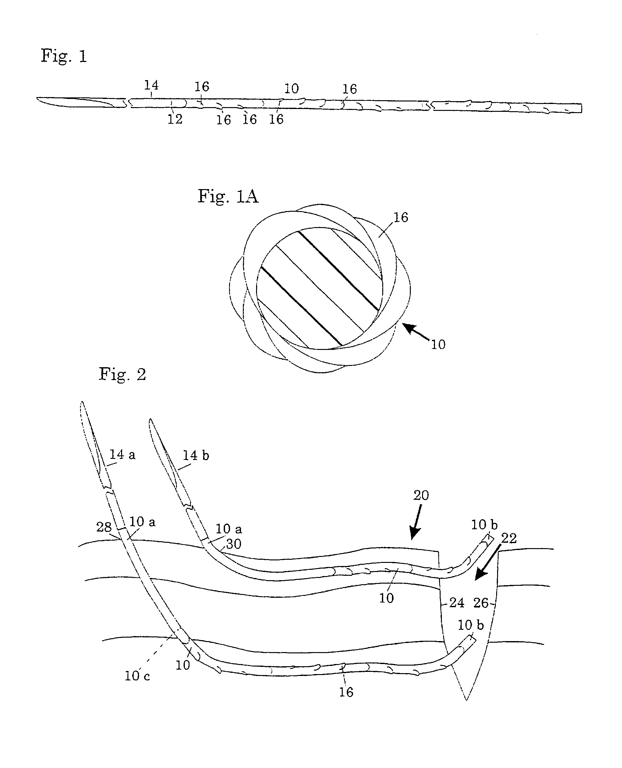 Surgical methods using one-way suture