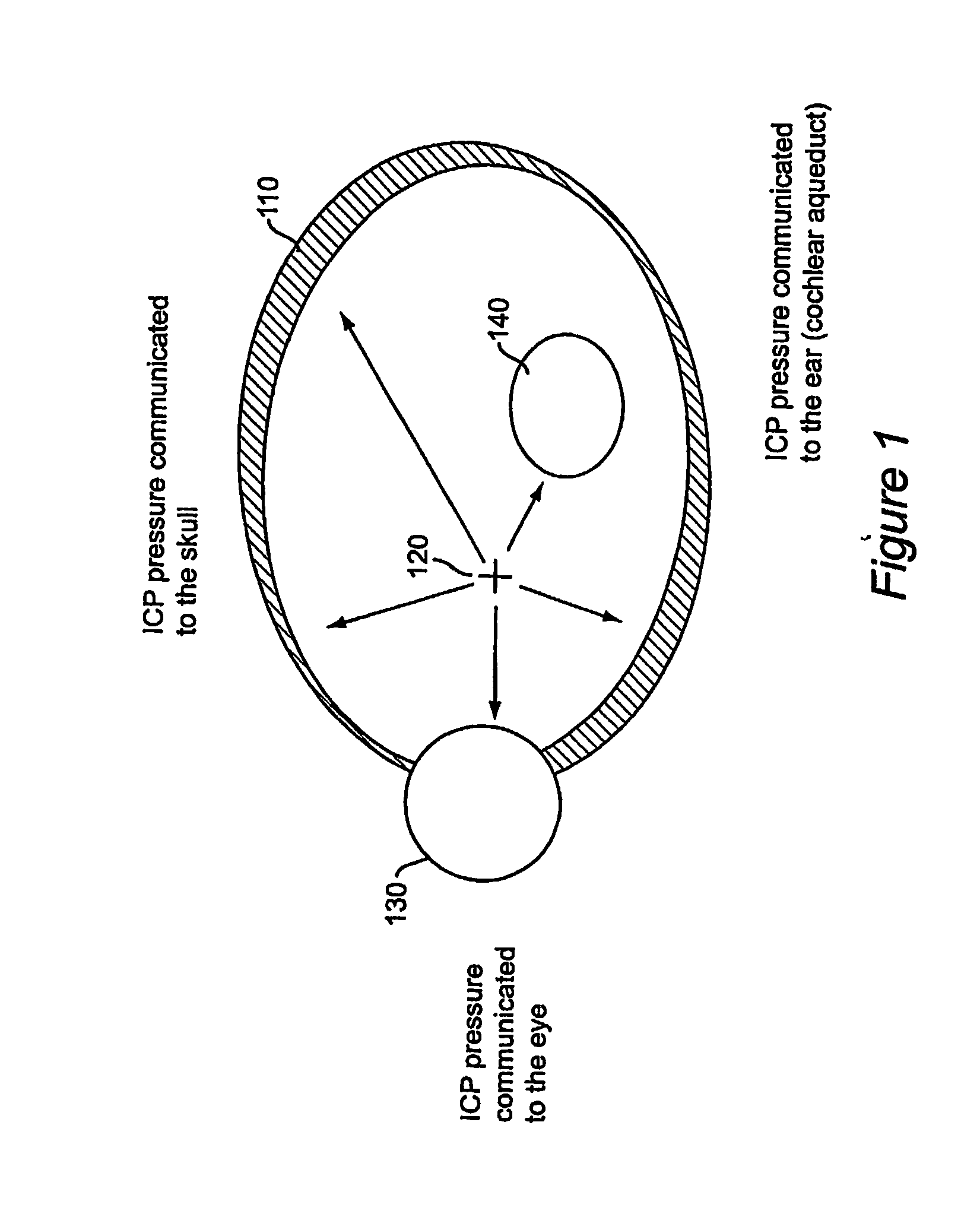 Method and apparatus for monitoring intra ocular and intra cranial pressure