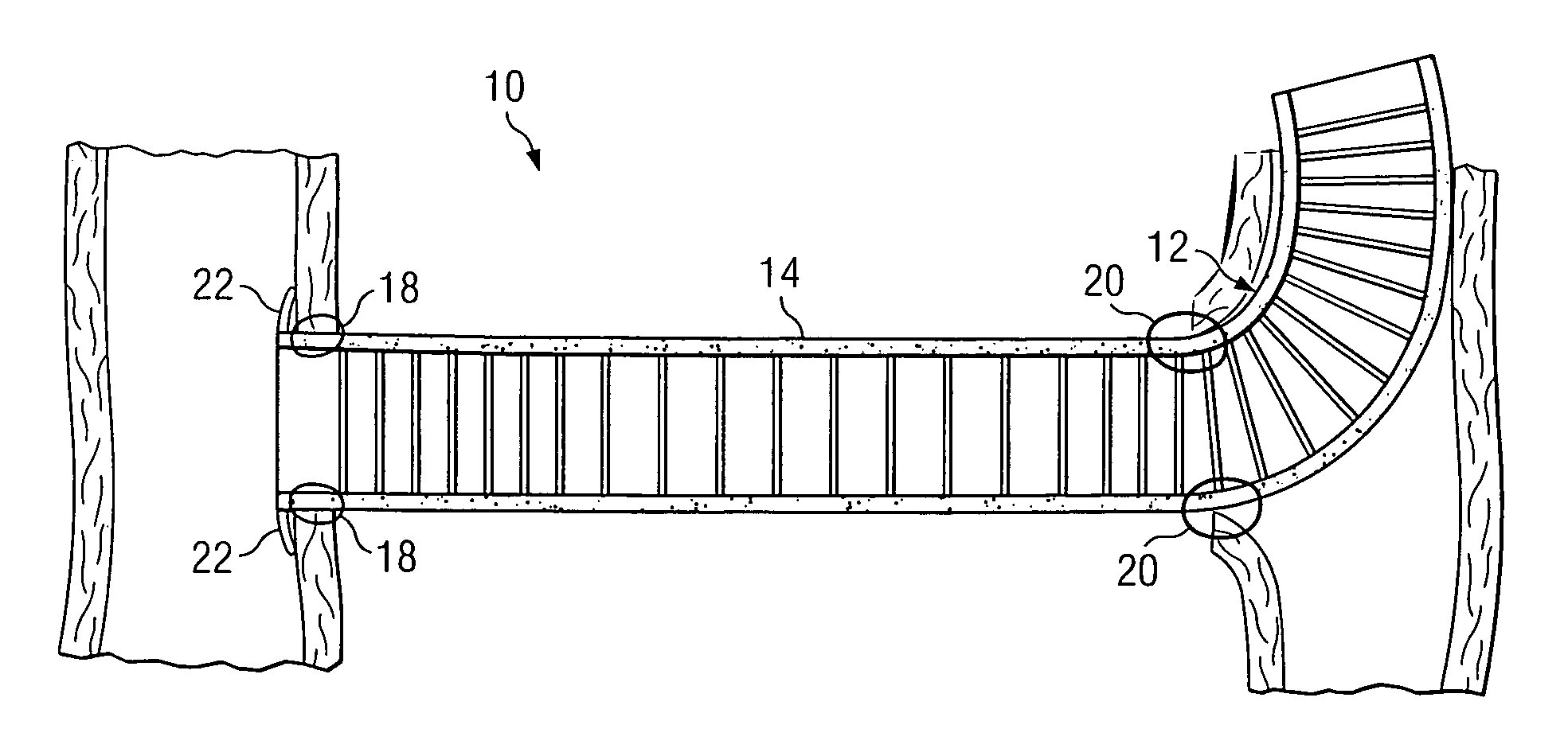 System and method for providing a graft in a vascular environment