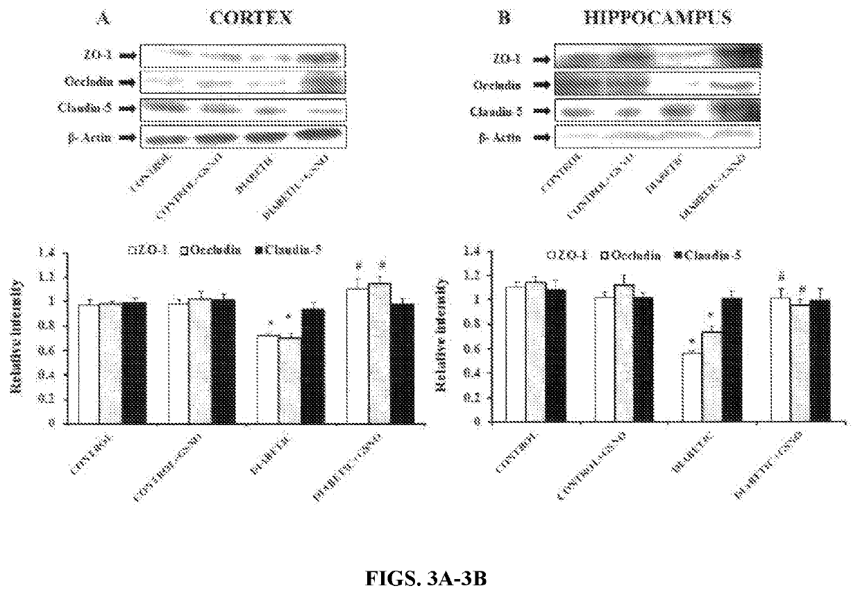 S-nitrosoglutathione (GSNO) and gsno reductase inhibitors for use in therapy