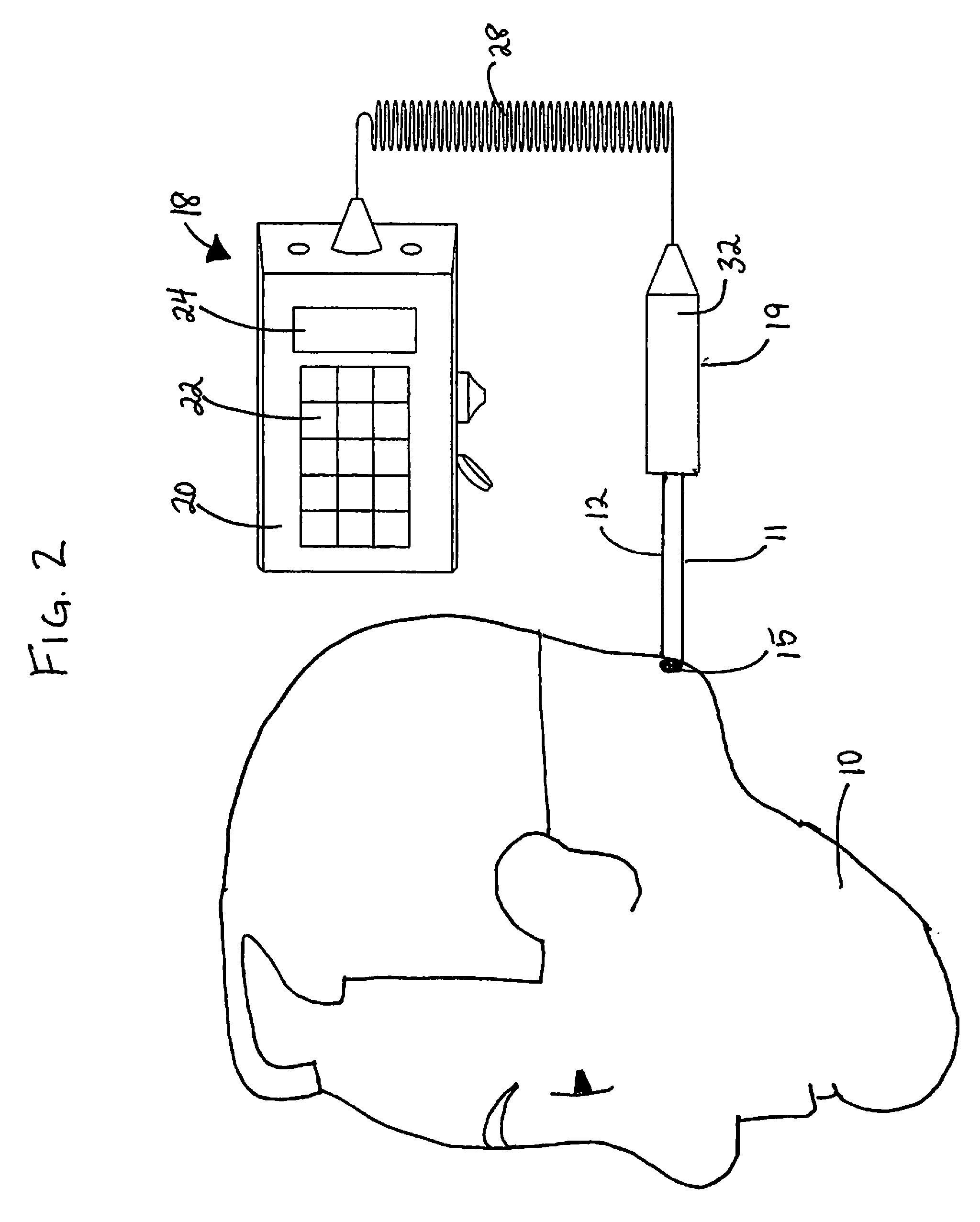 Adjustable Polarity Laser Device and Polarized Low-Level Laser Therapy Method