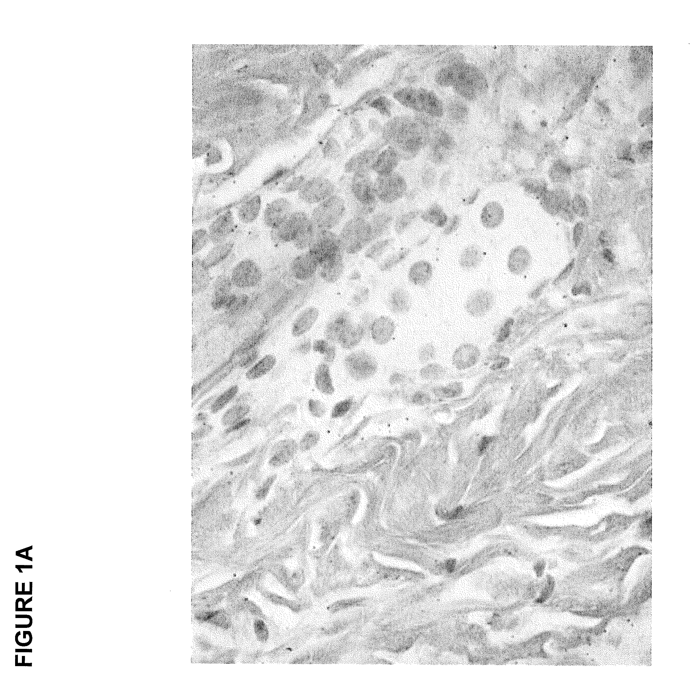 Modulators of SC4MOL for treating acne or hyperseborrhea