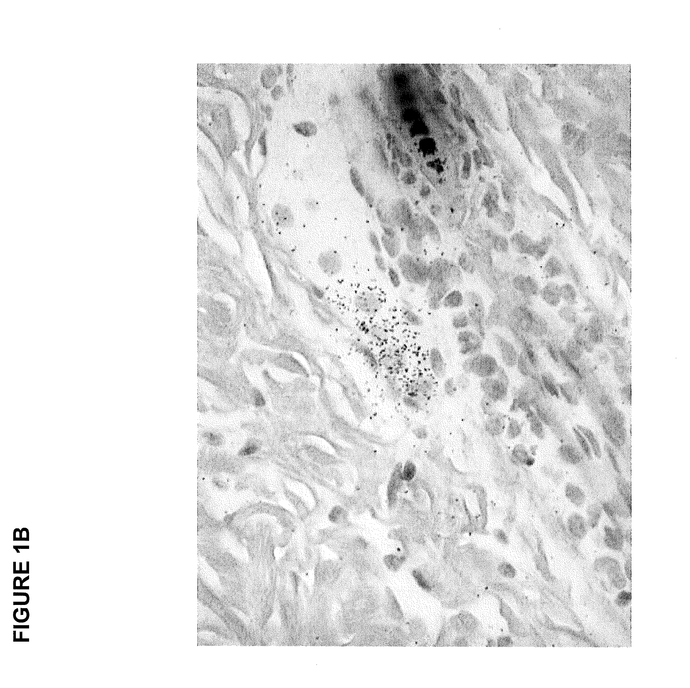 Modulators of SC4MOL for treating acne or hyperseborrhea