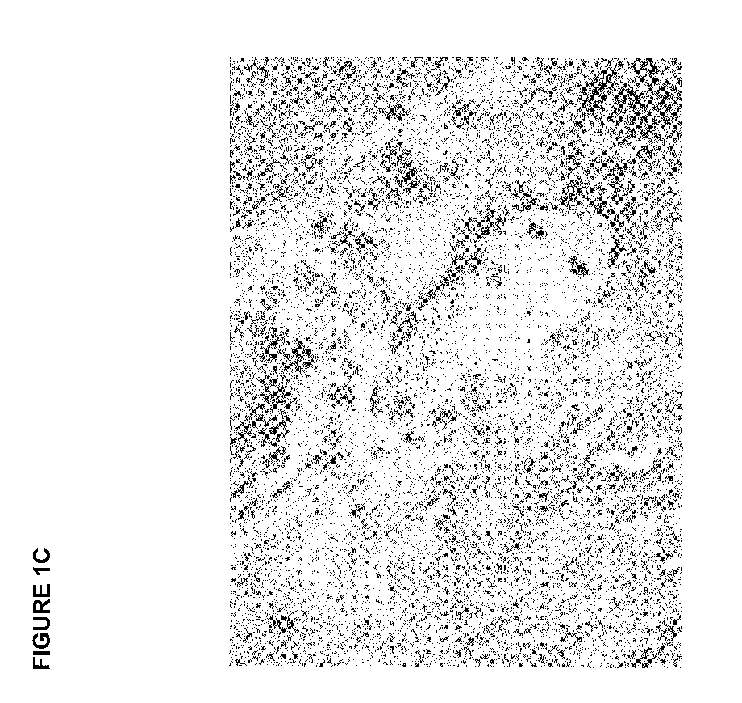 Modulators of SC4MOL for treating acne or hyperseborrhea