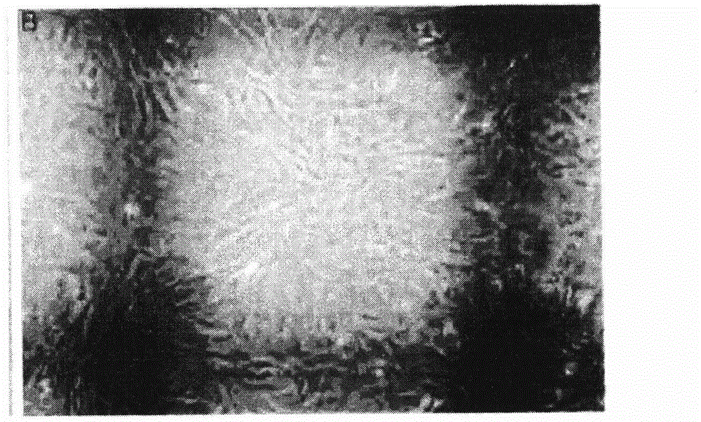 Preparation method and application of autologous mesenchymal stem cell-loaded human amniotic membrane cornea paster