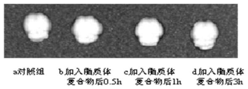 Liposome complex impermeable to blood-brain barrier and preparation method thereof