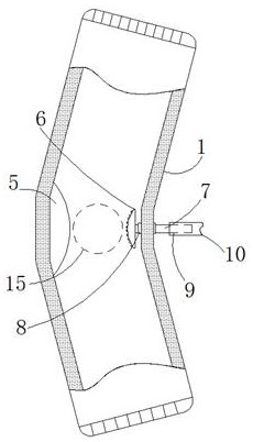 Knee joint rehabilitation limiter for department of pediatrics