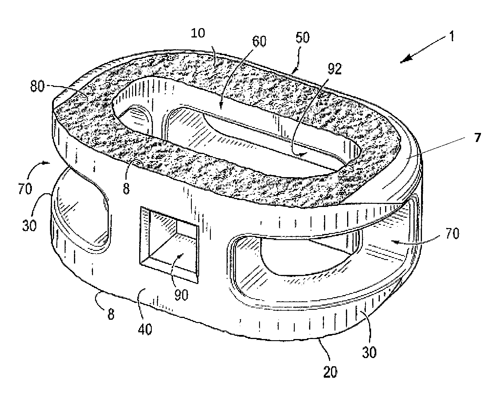 Processes for producing regular repeating patterns on surfaces of interbody devices