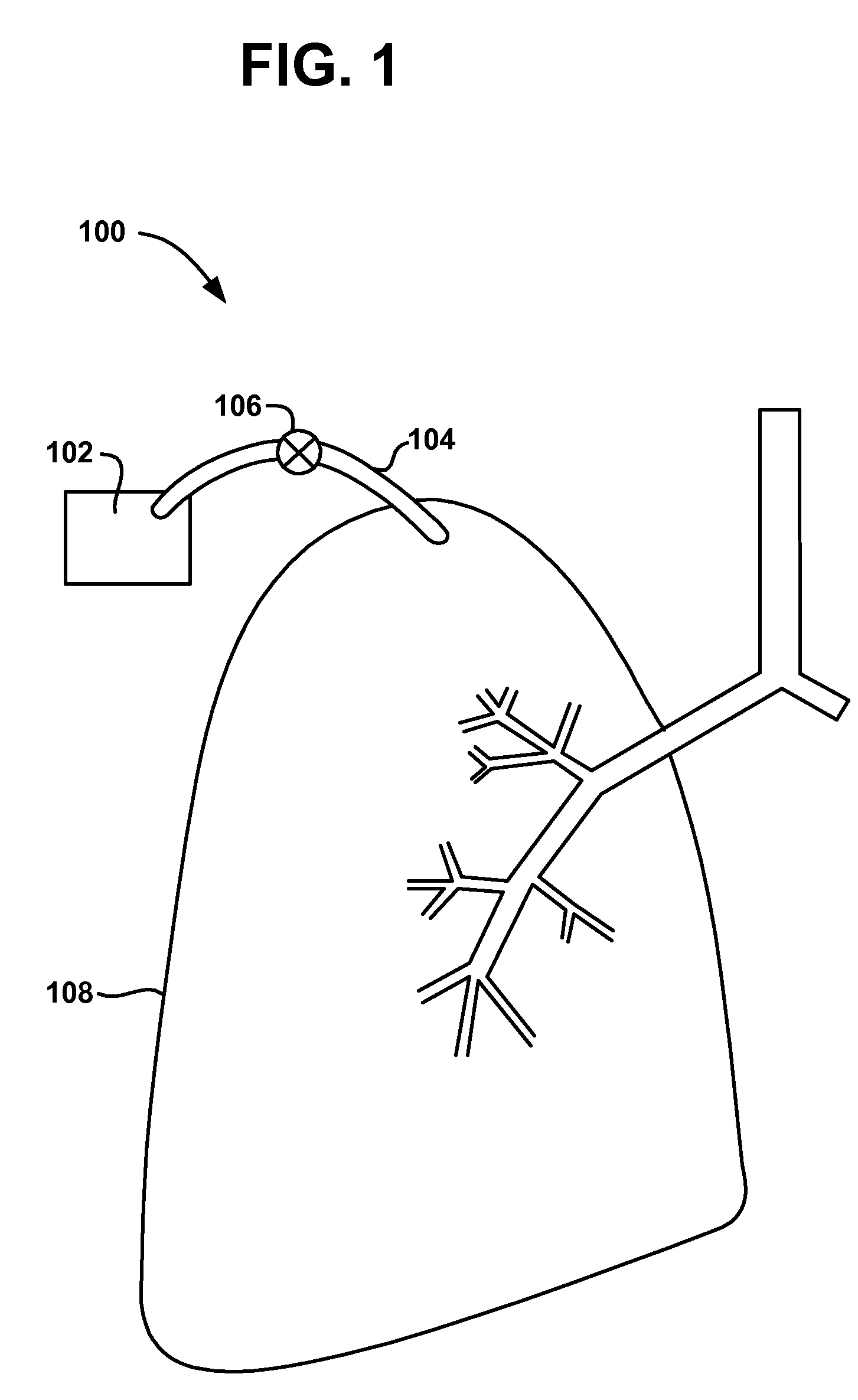 Variable parietal/visceral pleural coupling