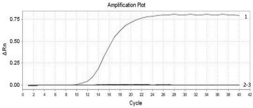 Real-time fluorescence RT-PCR detection kit for H1N1 type A swine influenza virus and application of detection kit