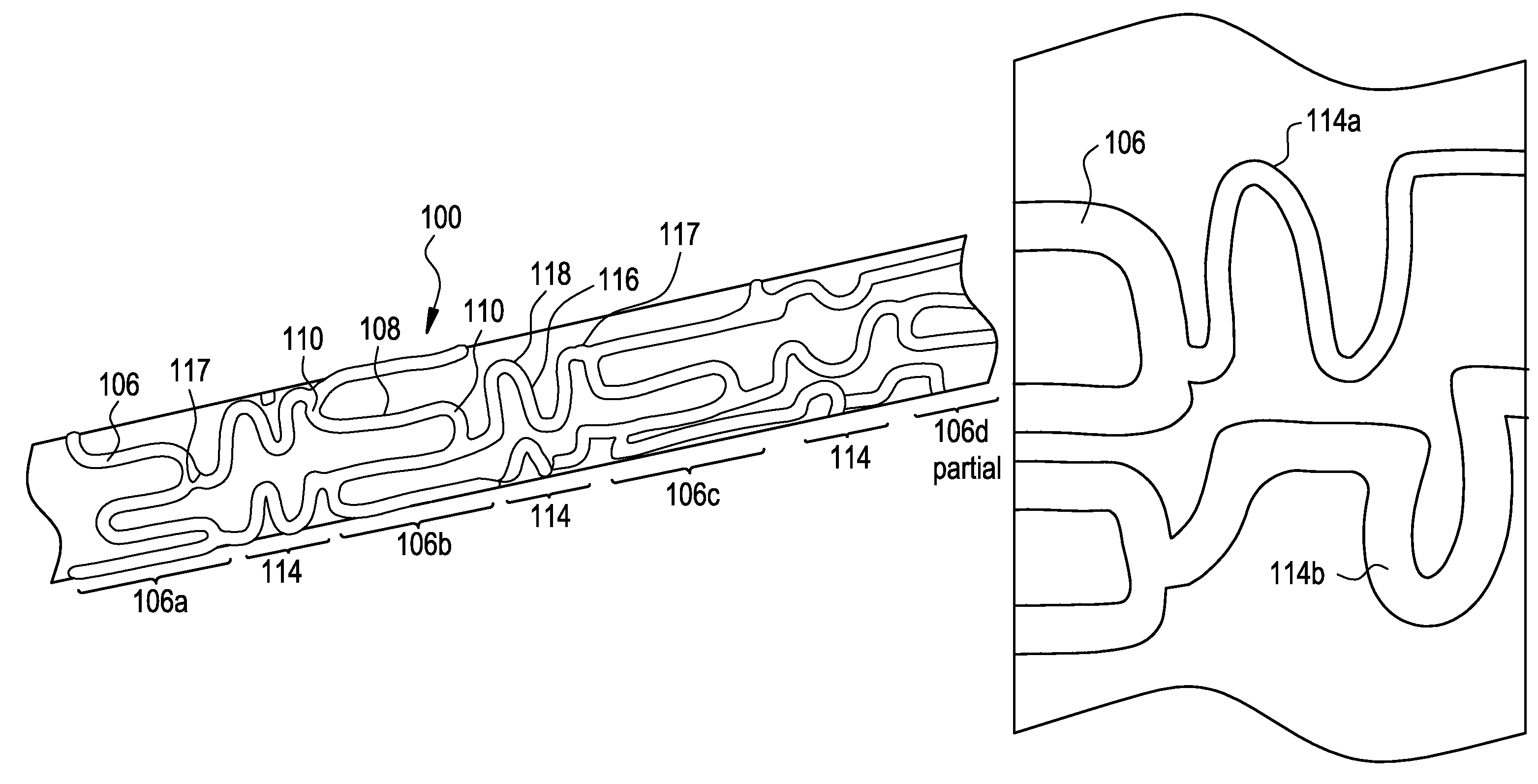 Intraluminal medical device having variable axial flexibility about the circumference of the device