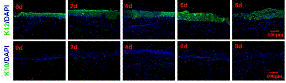 Preservation method for corneal limbus tissue