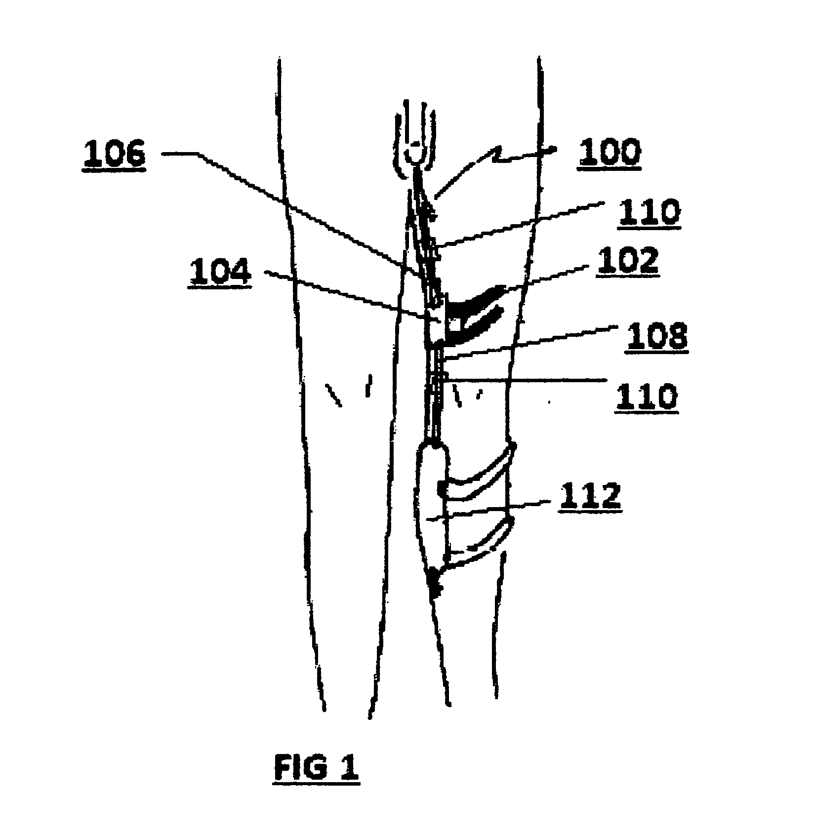 Medical tubing and catheter control