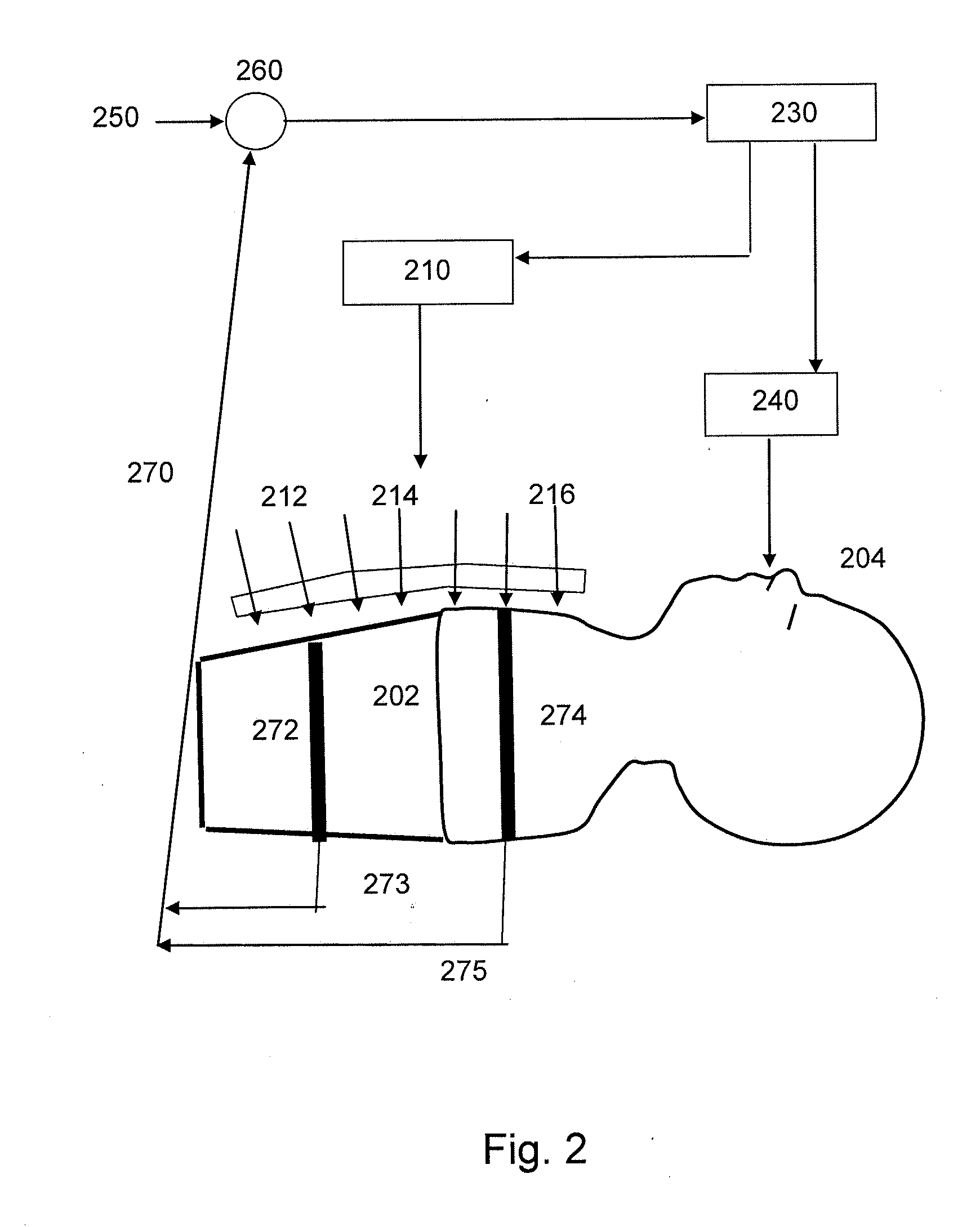 Extrathoracic Augmentation of the Respiratory Pump