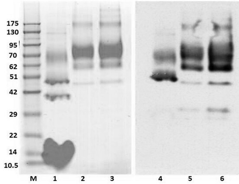 Infectious bursal disease virus VP2 protein as well as encoding gene and application thereof