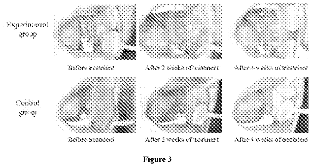 Product derived from rhodococcus ruber, and pharmaceutical use thereof