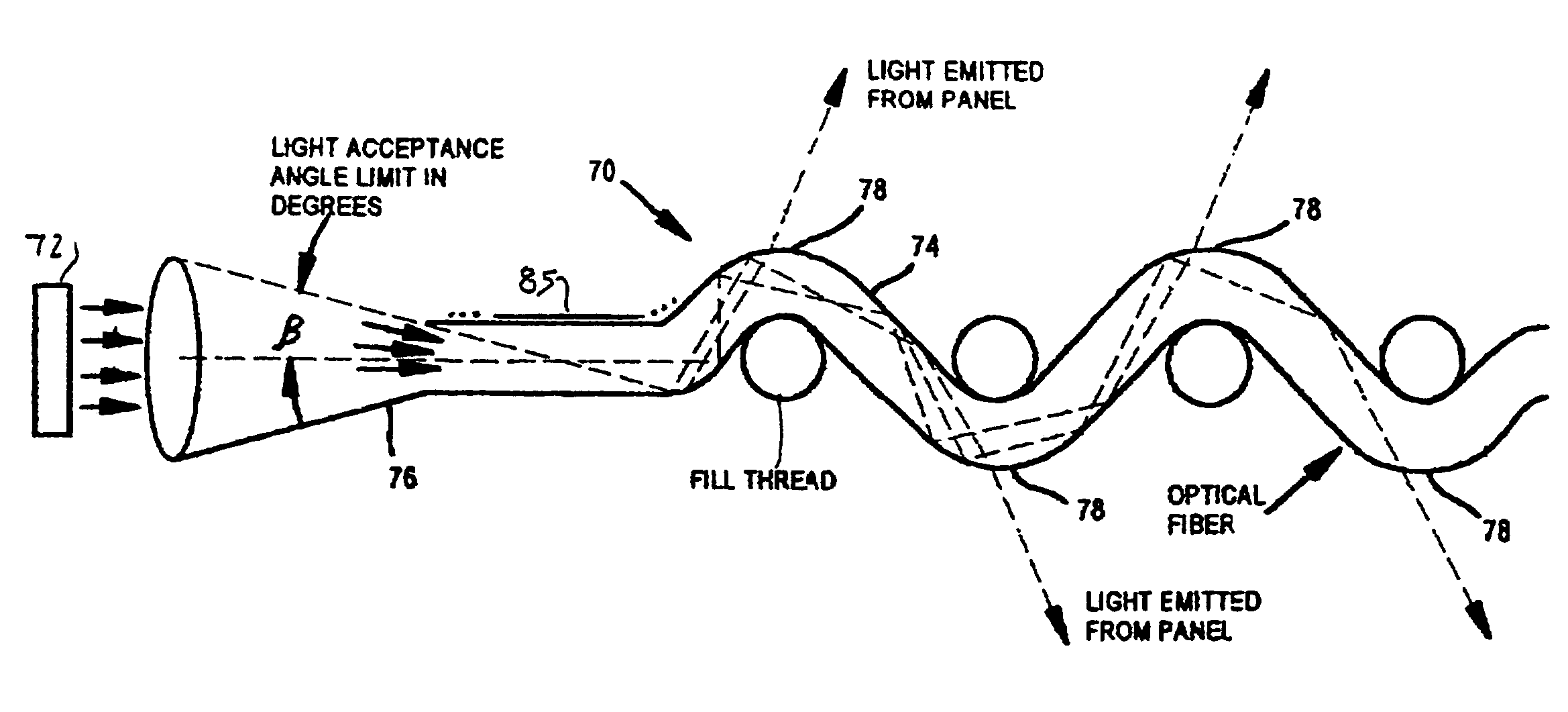 System for treatment of acne skin condition using a narrow band light source