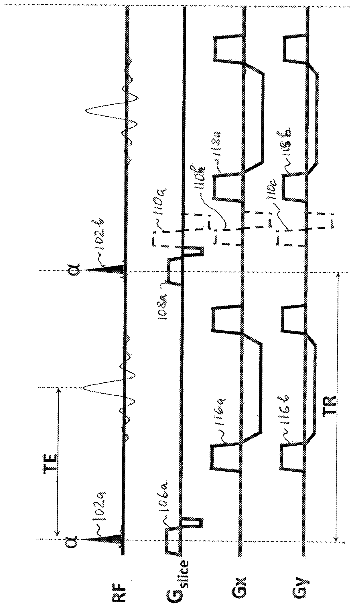 Cine phase contrast simultaneous multi-slice and multi-slab imaging of blood flow and cerebrospinal fluid motion