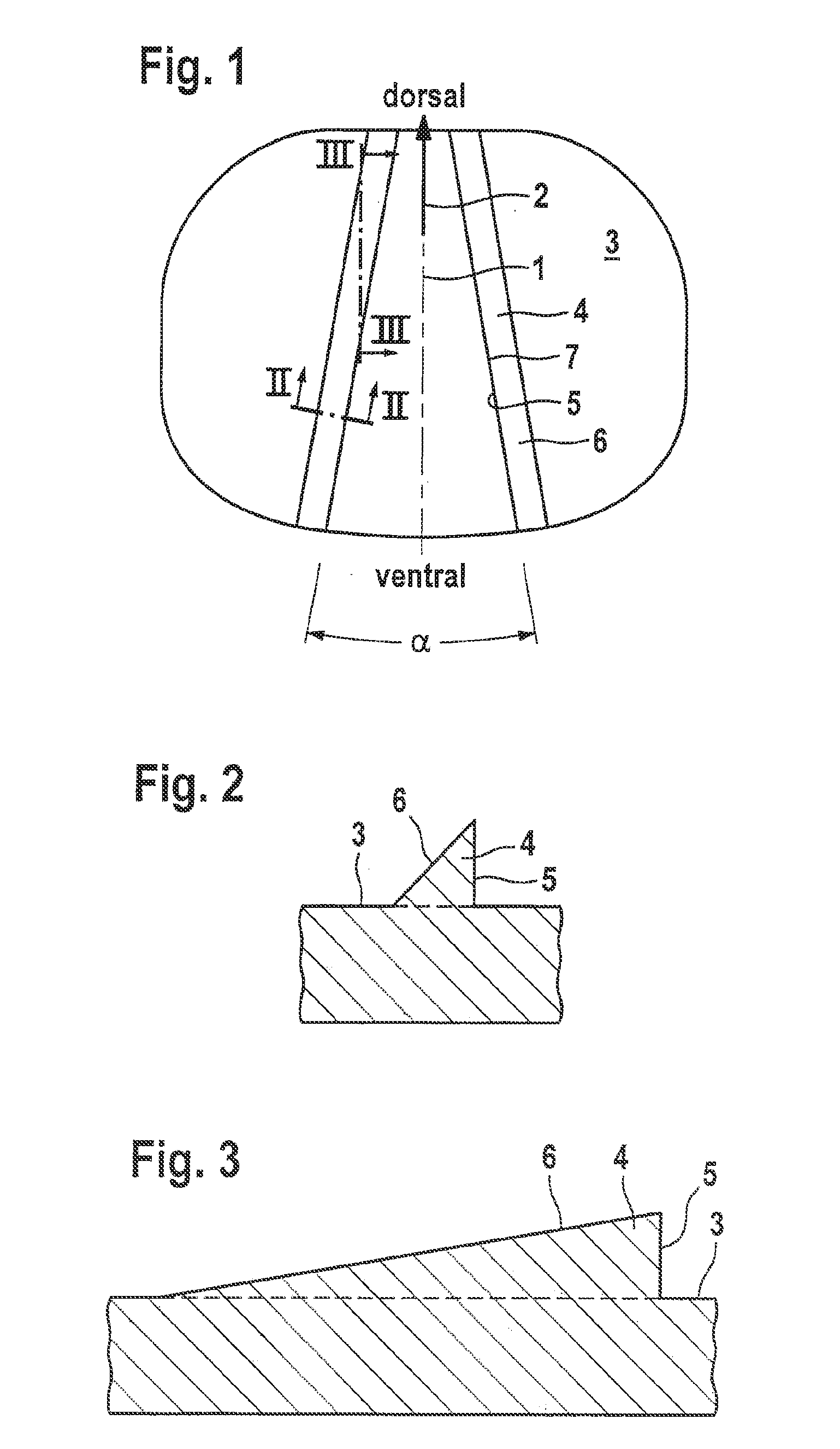 Intervertebral prosthesis with self-tapping fixing projections