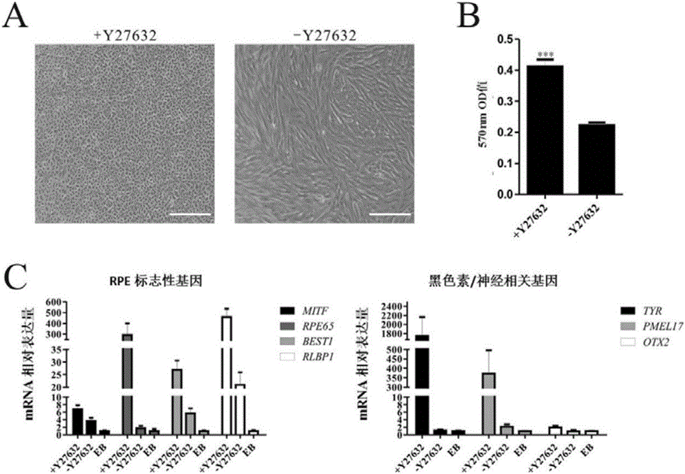 Culture solution for retinal pigment epitheliums and preparation method and application thereof