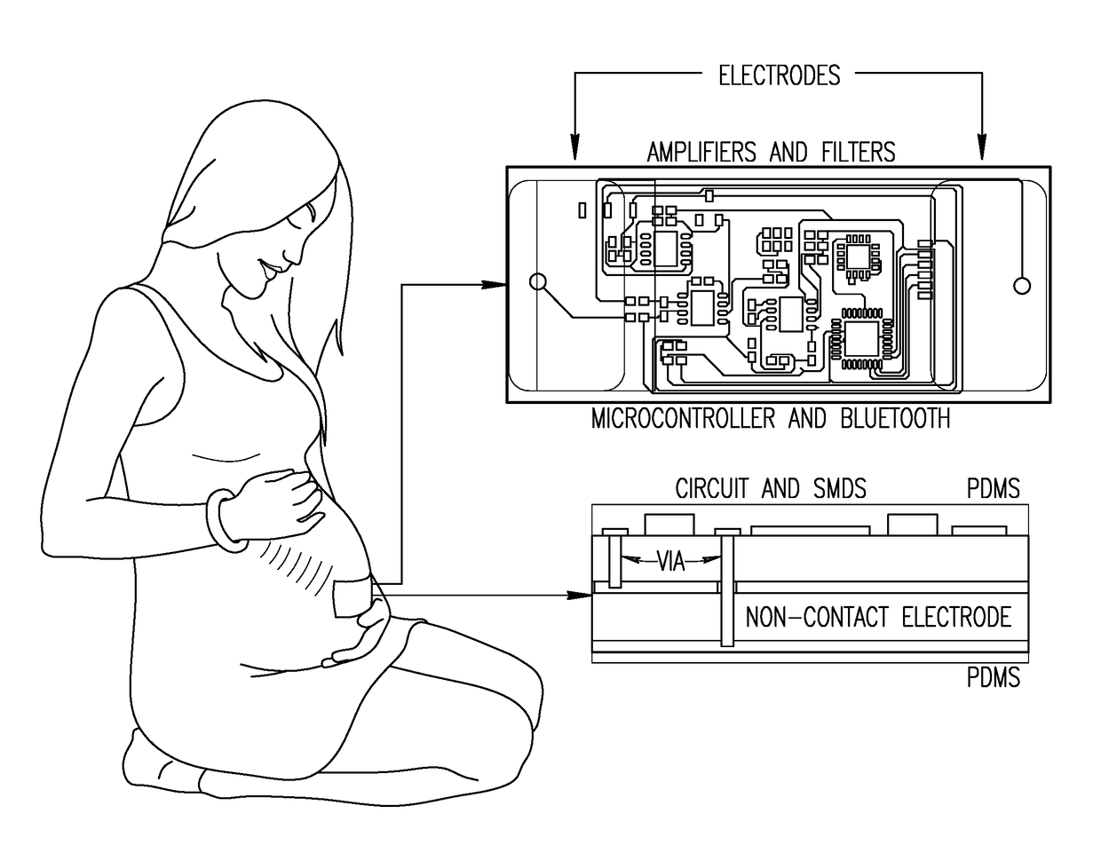 Fetal ECG and heart rate assessment and monitoring device