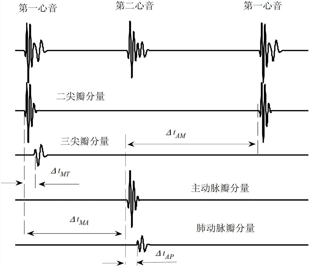 Pulmonary circulation blood pressure monitoring equipment based on body surface phonocardiogram and method for monitoring pulmonary circulation blood pressure by using equipment