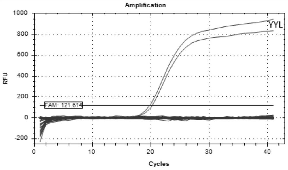 Procypris rabaudi real-time fluorescent PCR (polymerase chain reaction) amplification primer, probe and detection method based on environmental DNA (deoxyribonucleic acid)