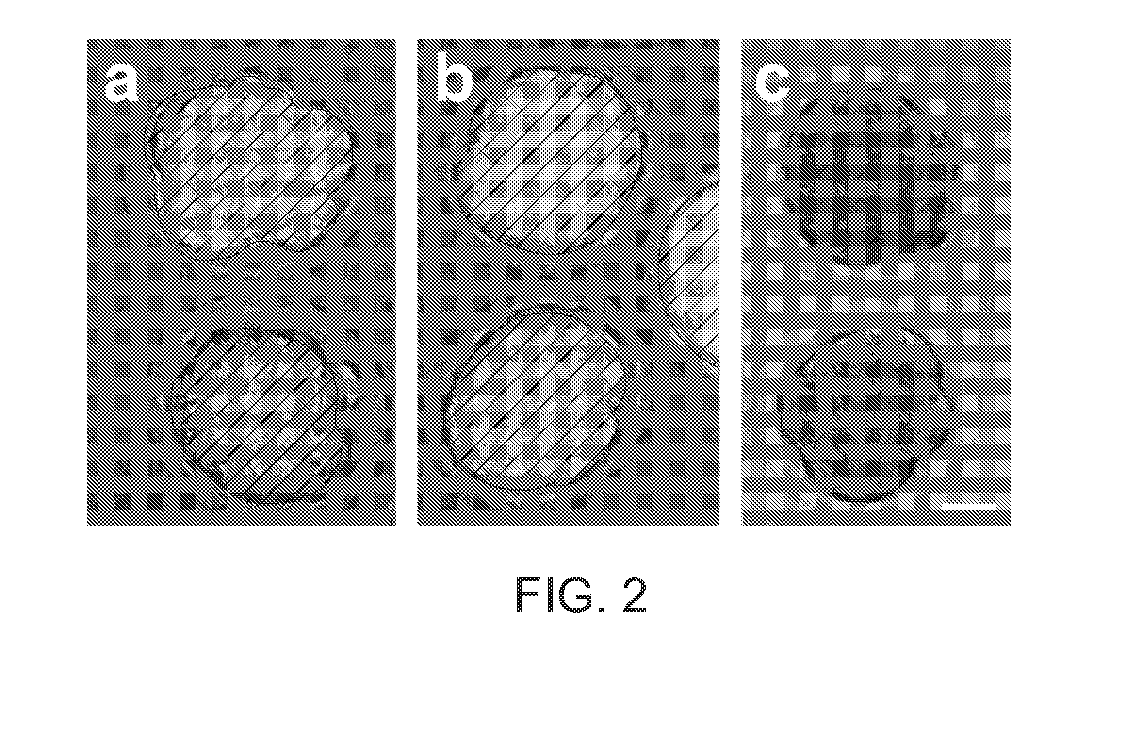 Inhibiting Gene Expression with dsRNA