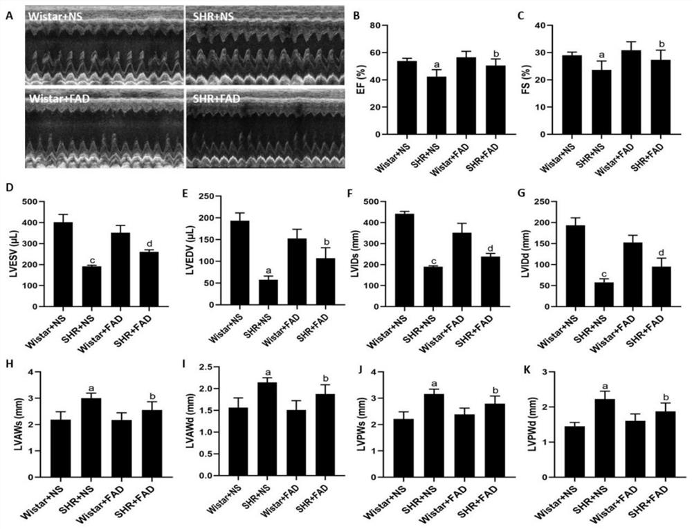 Application of fad in the preparation of drugs for inhibiting or treating diseases of the cardiovascular system