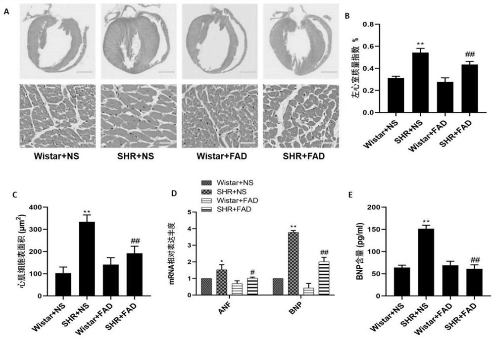 Application of fad in the preparation of drugs for inhibiting or treating diseases of the cardiovascular system