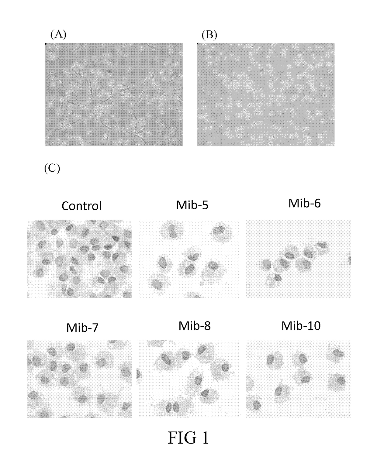 Farnesyl transferase inhibitors and uses thereof