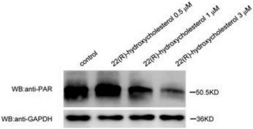 Application of 22 (R)-hydroxycholesterol as PARP1 inhibitor