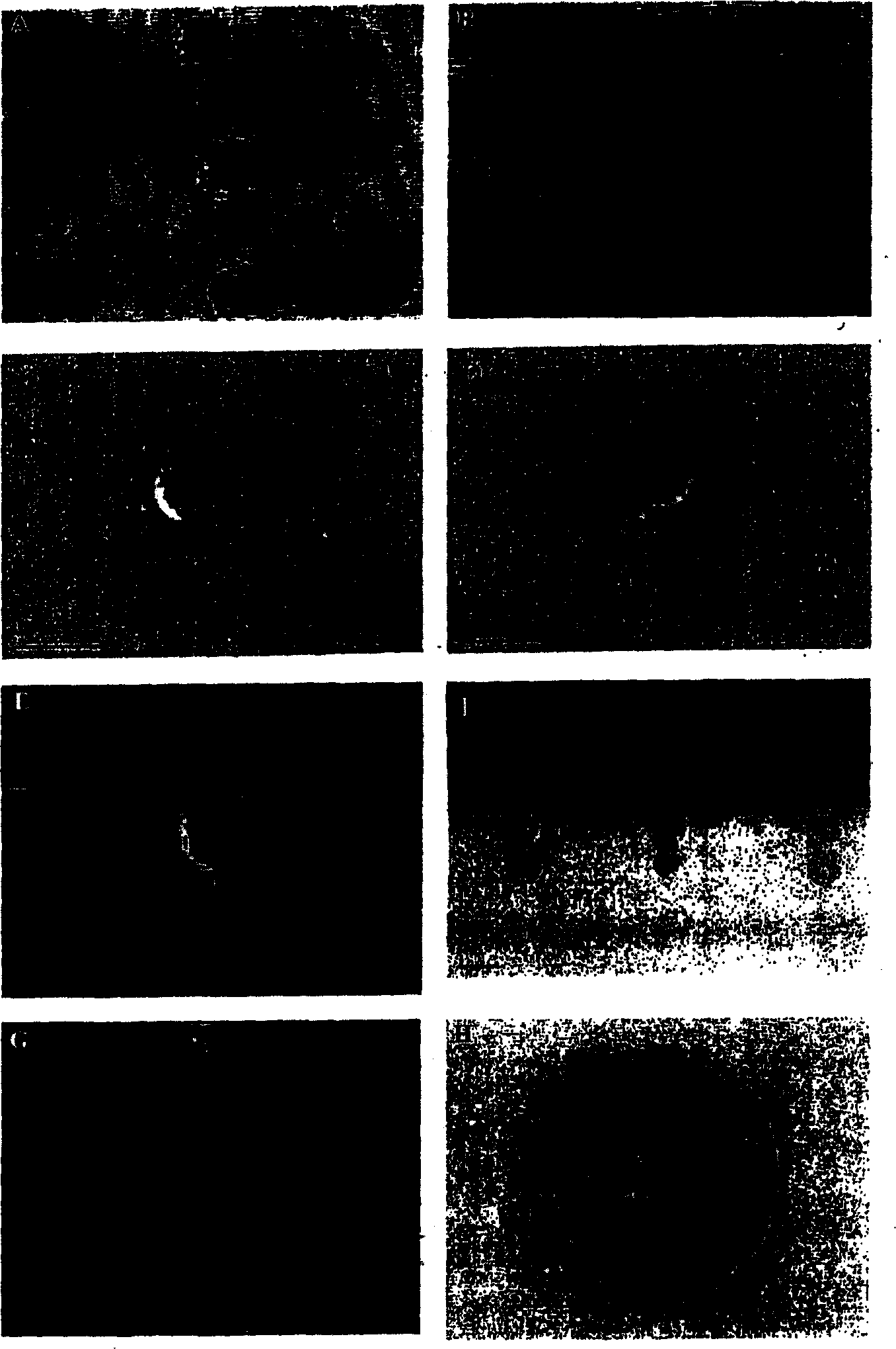 Method of nuclear transfer