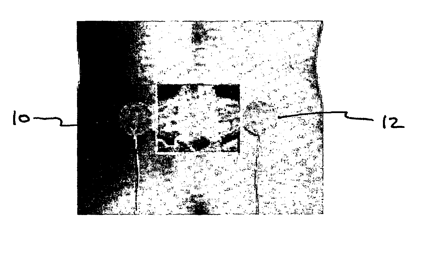 Method for treating degenerative disc disease using noninvasive capacitively coupled electrical stimulation device