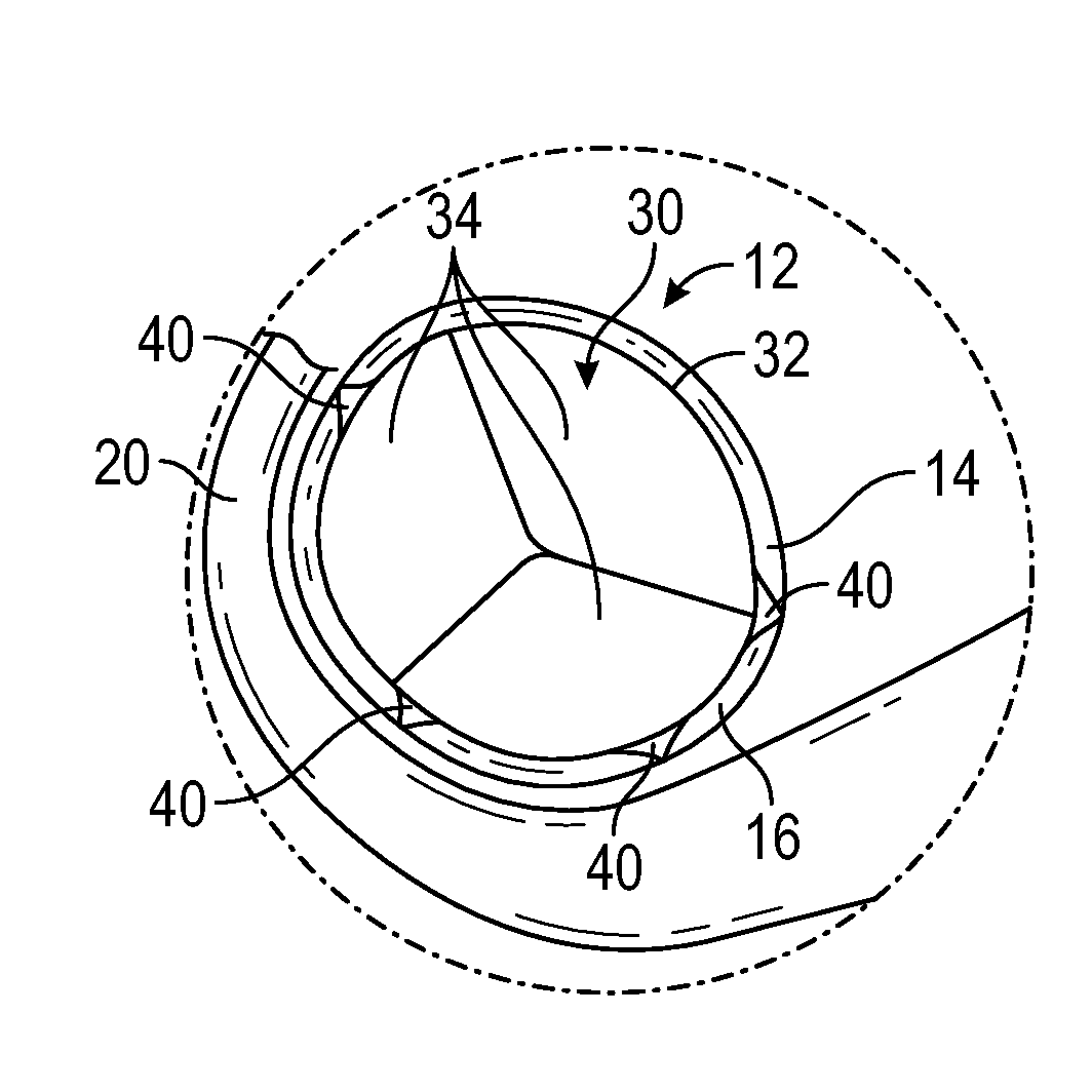 Methods and devices for reducing paravalvular leakage