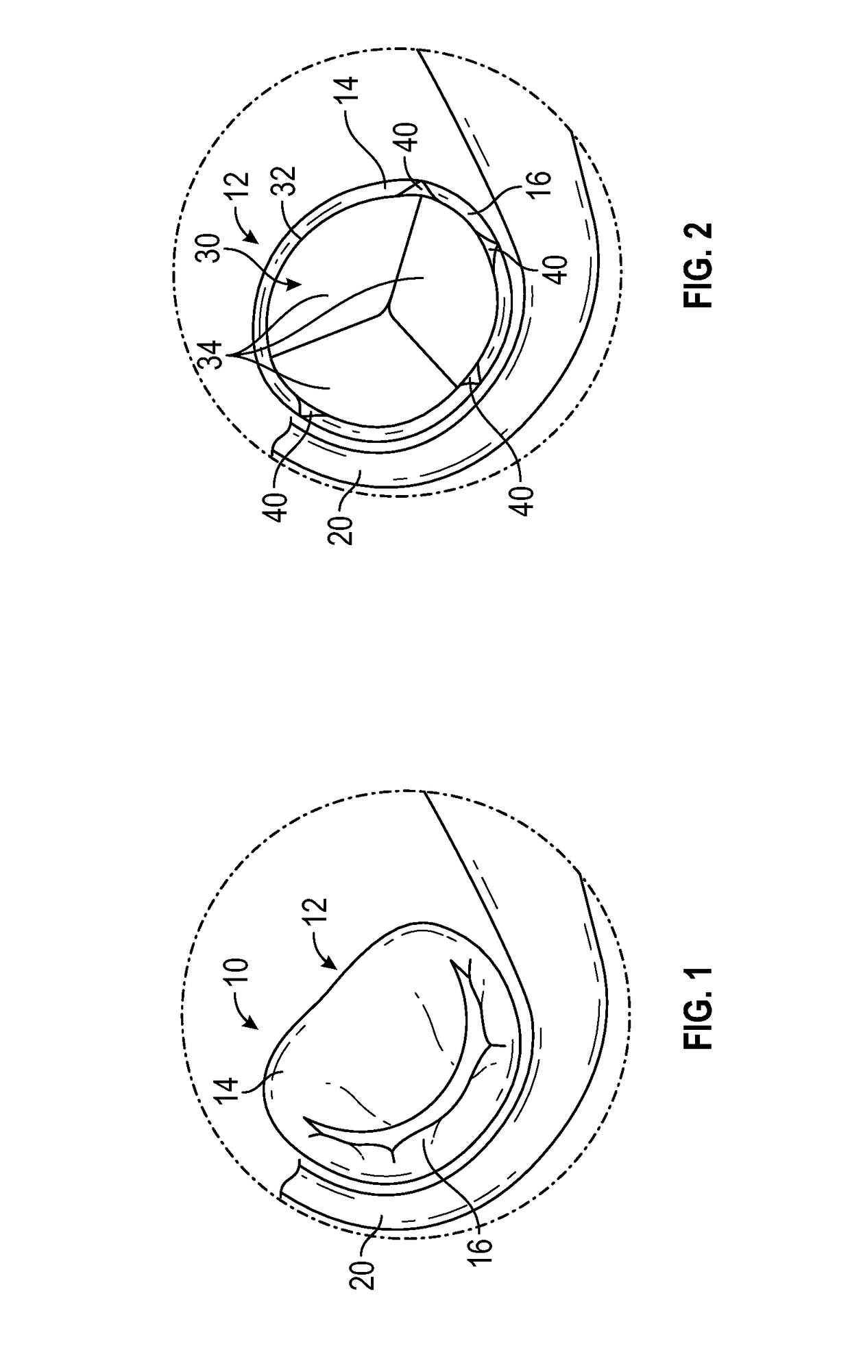 Methods and devices for reducing paravalvular leakage