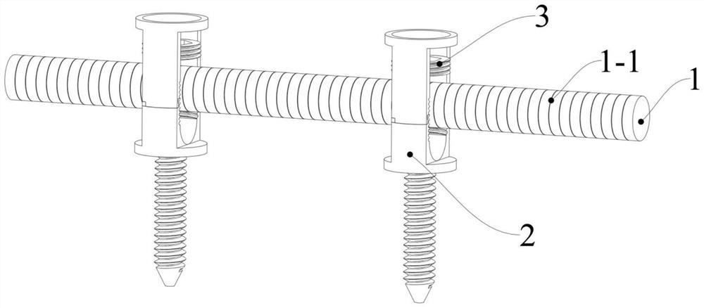 Pedicle screw rod internal fixing device taking positioning pin as inner core