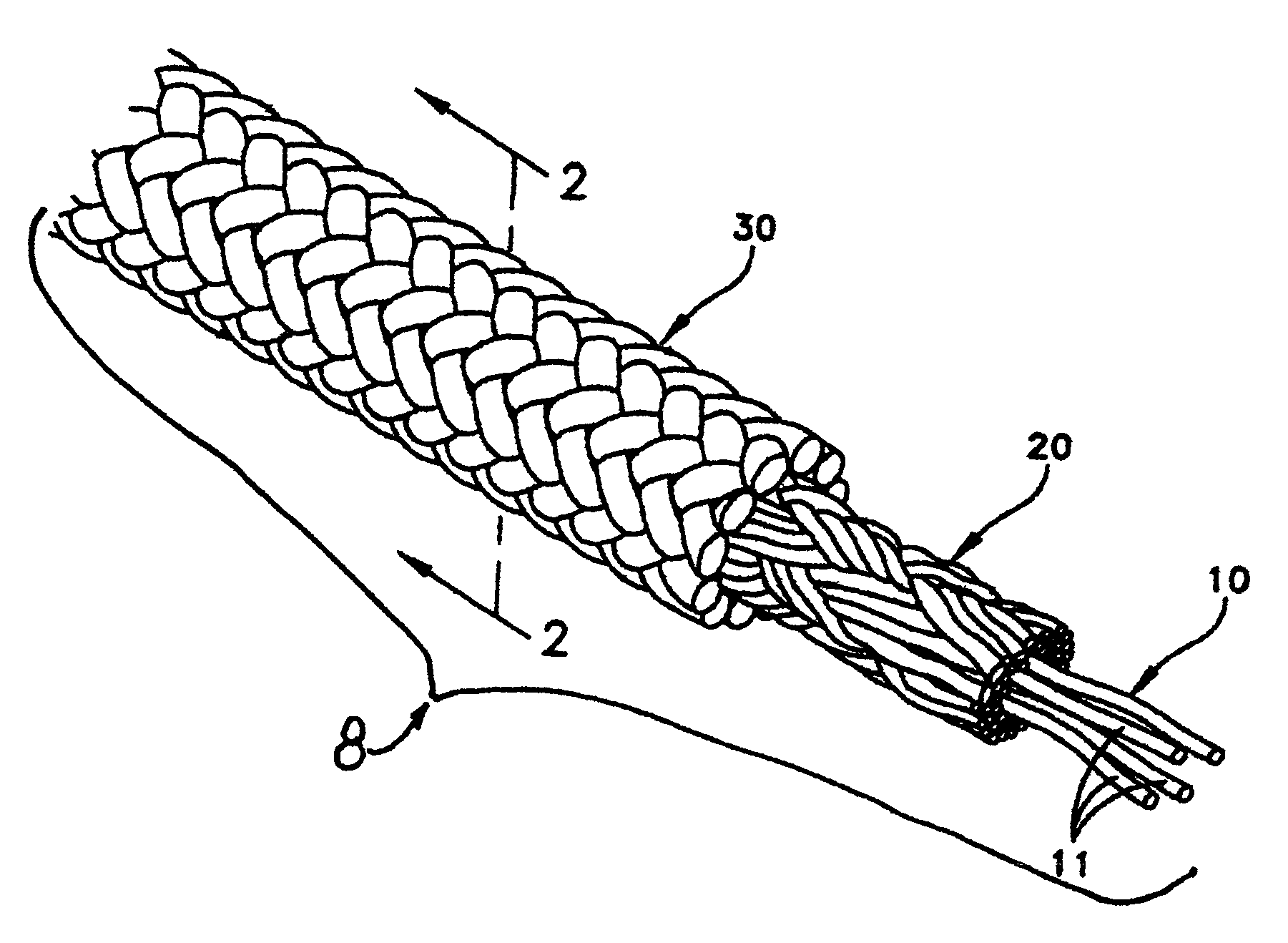 Arborist's climbing rope