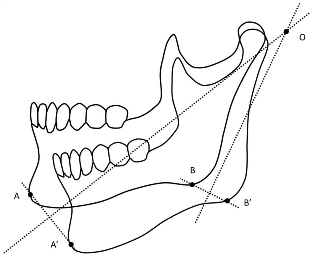 A method for extracting lateral rotation axis location of mandibular cbct data