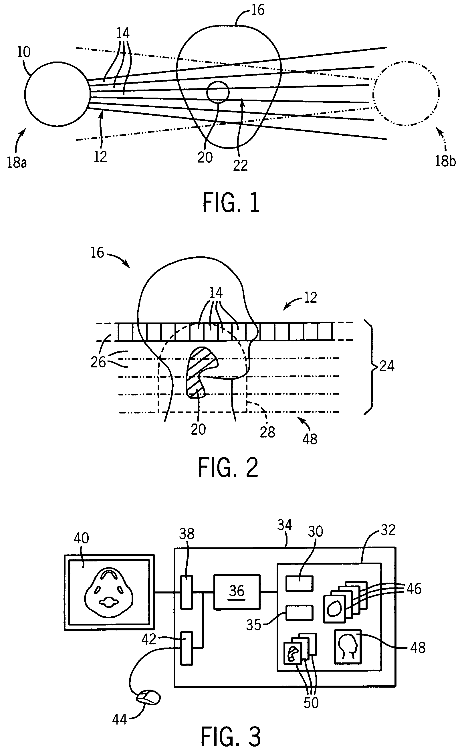 Radiation treatment planning using conformal avoidance