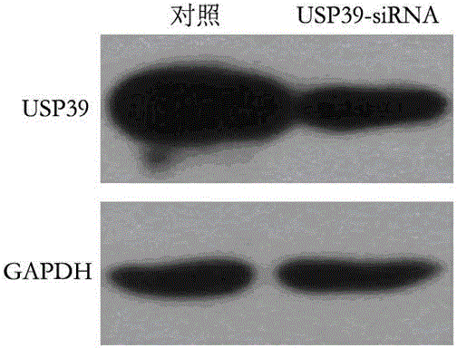 Recombinant lentiviral vector containing ubiquitin-specific protease gene USP39-shRNA (short hairpin ribonucleic acid) and application thereof