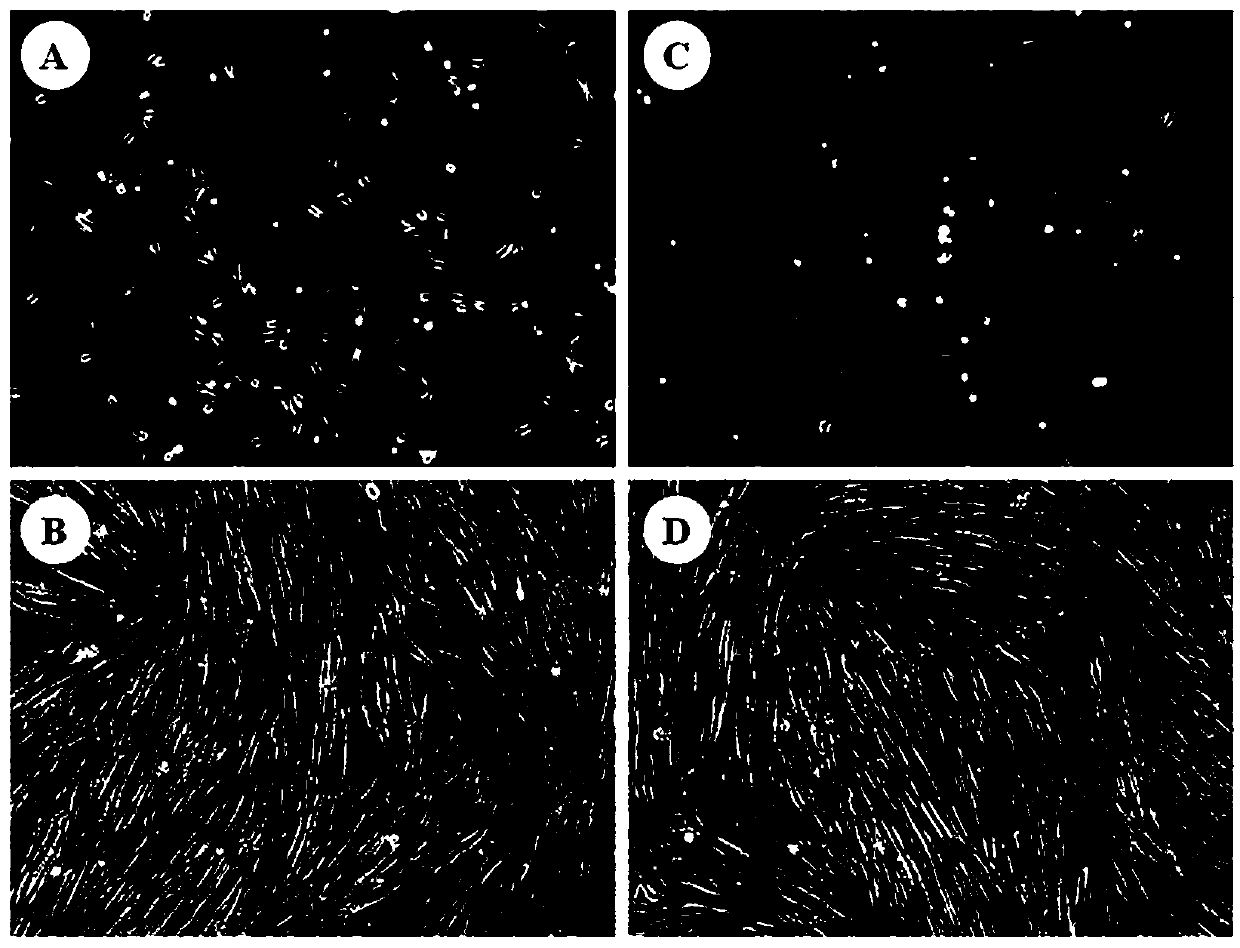 Use of hAMSCs (Human Amniotic Mesenchymal Stem Cells) in preparing drug for treating acute graft-versus-host disease