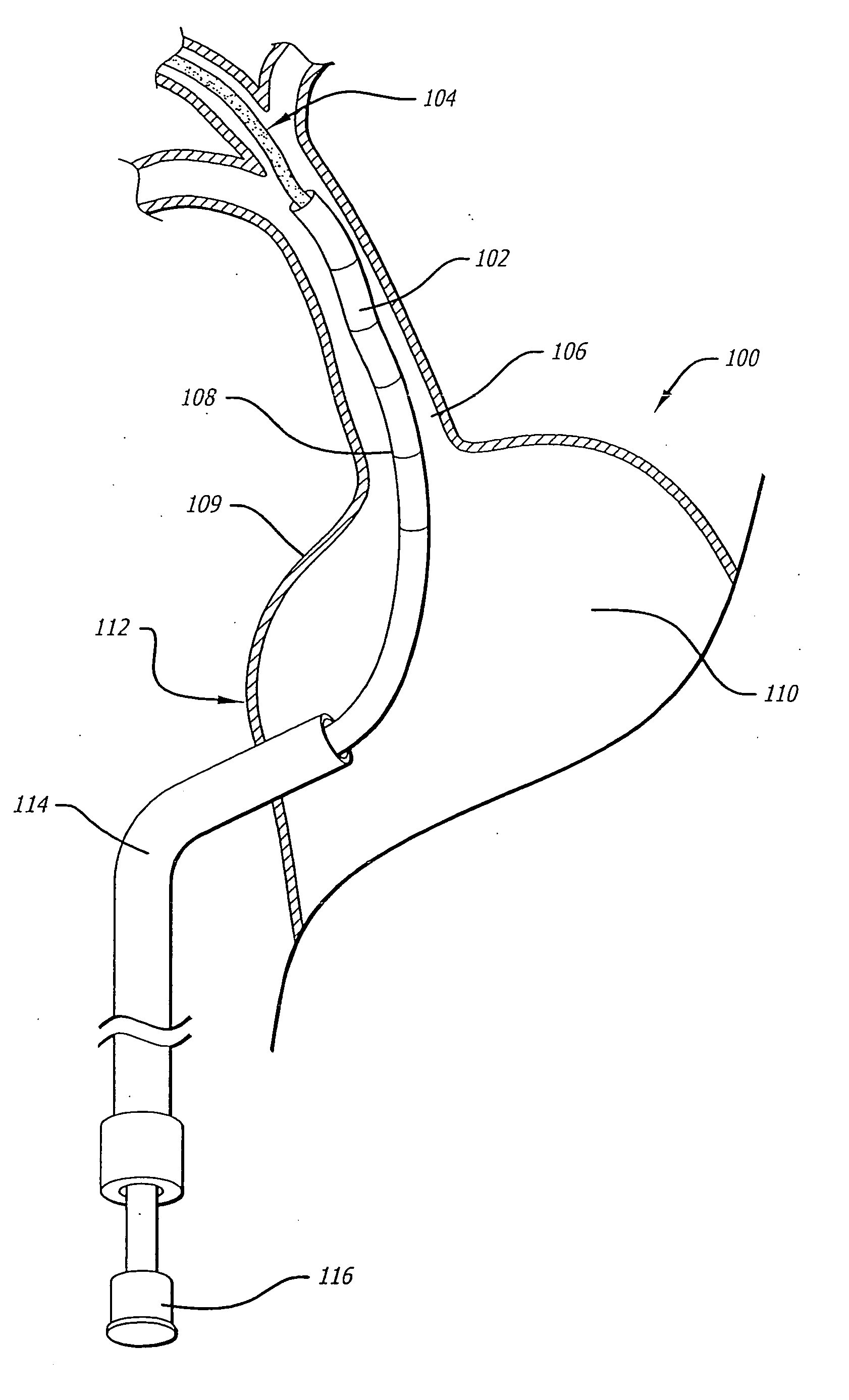 Ablation tools and positioning devices therefor