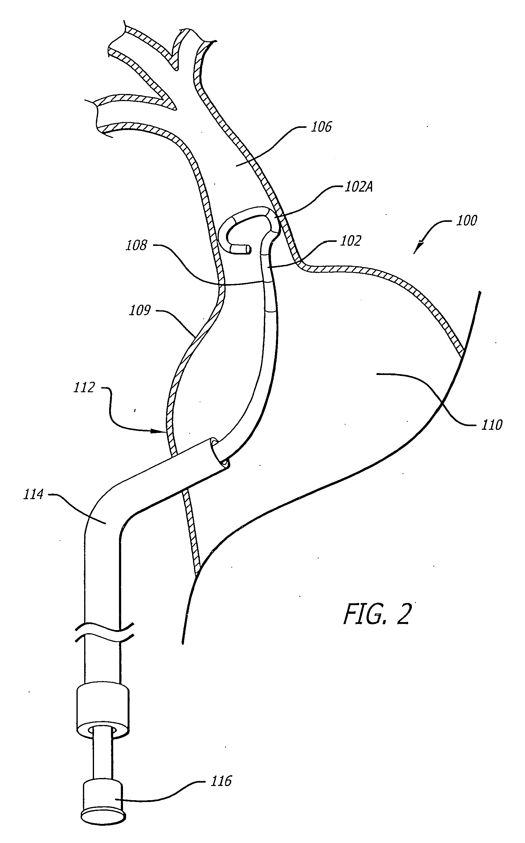 Ablation tools and positioning devices therefor