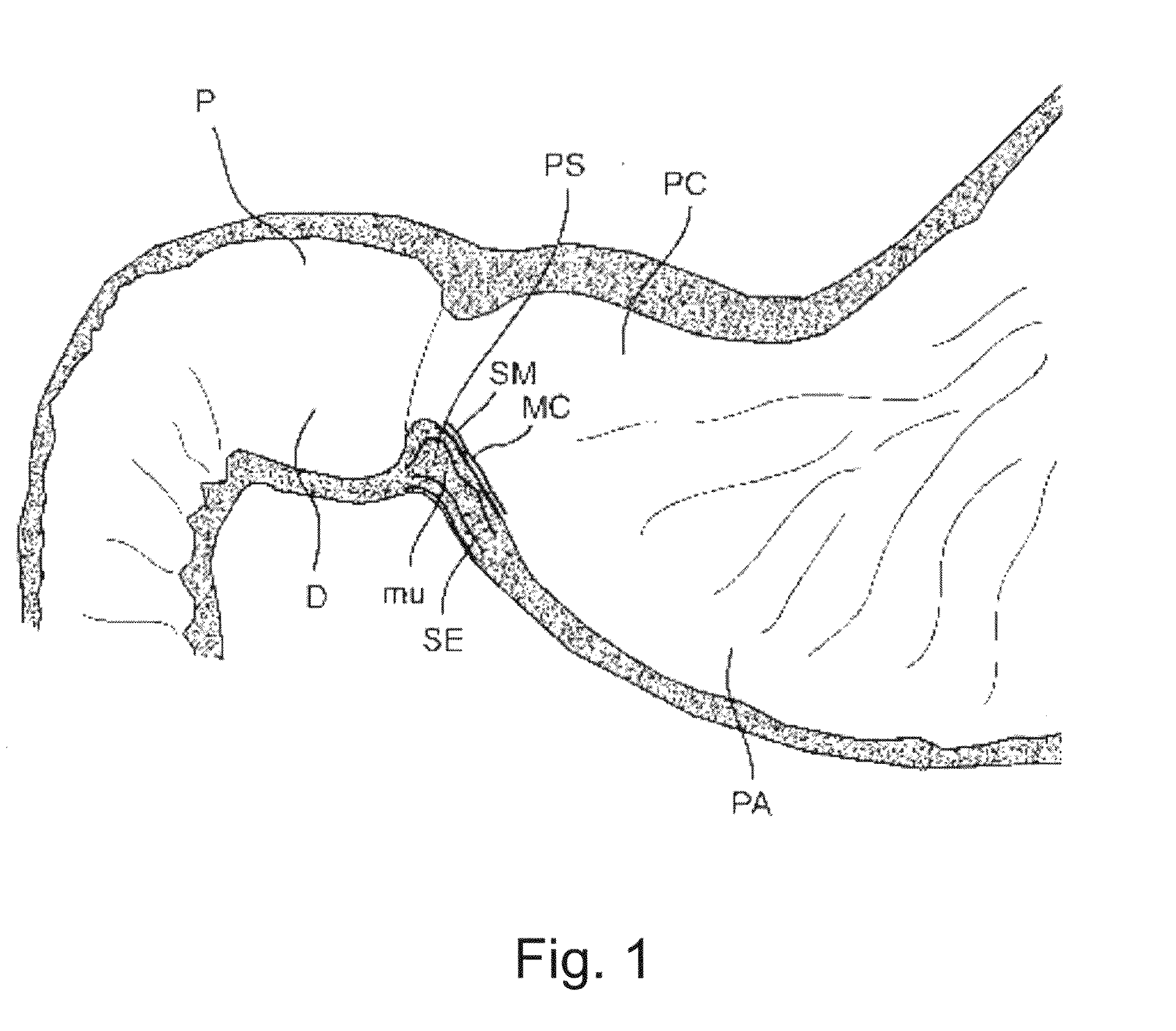 Devices and methods for altering eating behavior