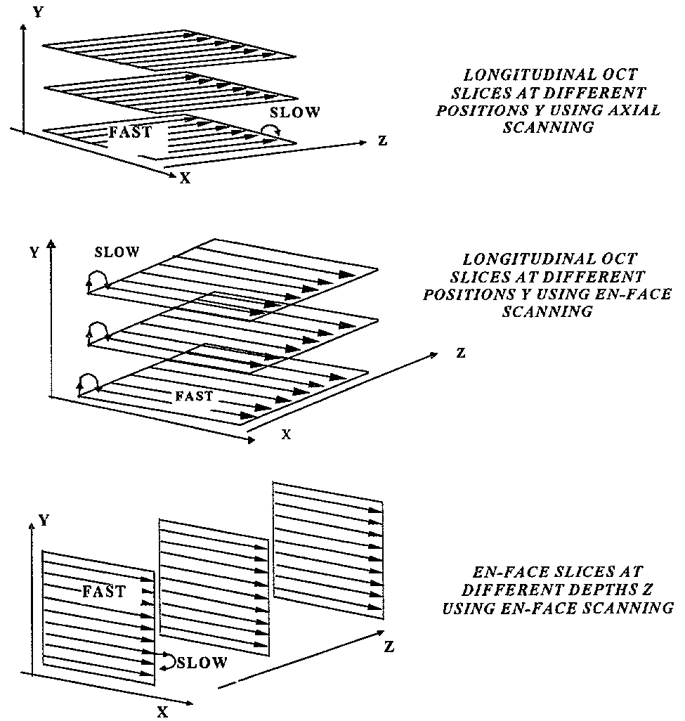 Apparatus for high resolution imaging of moving organs