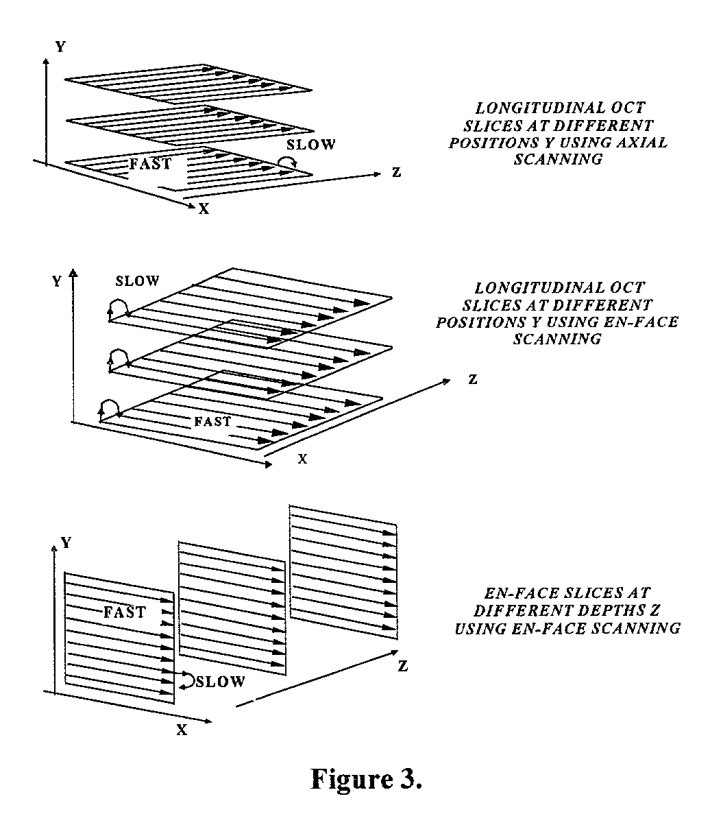 Apparatus for high resolution imaging of moving organs